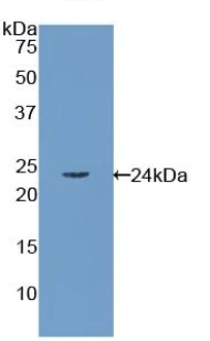 Western blot - Anti-RBP4 antibody (AB233138)