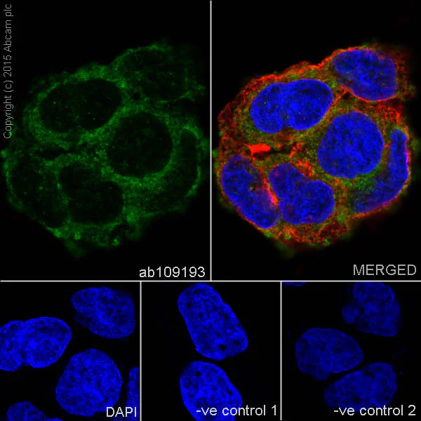 Immunocytochemistry/ Immunofluorescence - Anti-RBP4 antibody [EP3657] (AB109193)