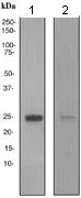 Western blot - Anti-RBP4 antibody [EP3657] (AB109193)