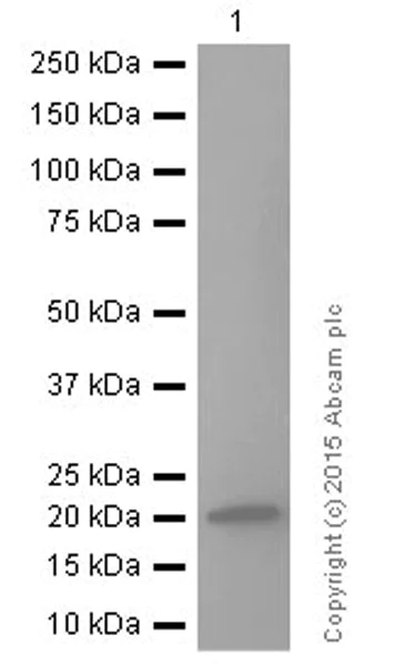 Western blot - Anti-RBP4 antibody [EP3657] (AB109193)