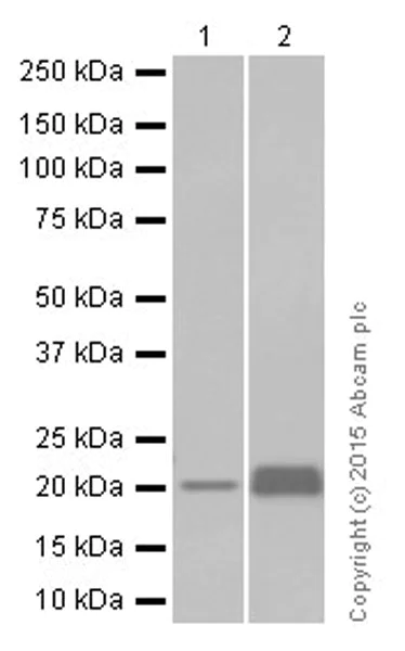 Western blot - Anti-RBP4 antibody [EP3657] (AB109193)