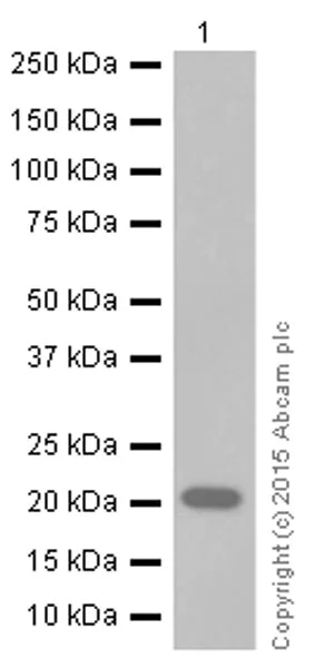 Western blot - Anti-RBP4 antibody [EP3657] (AB109193)