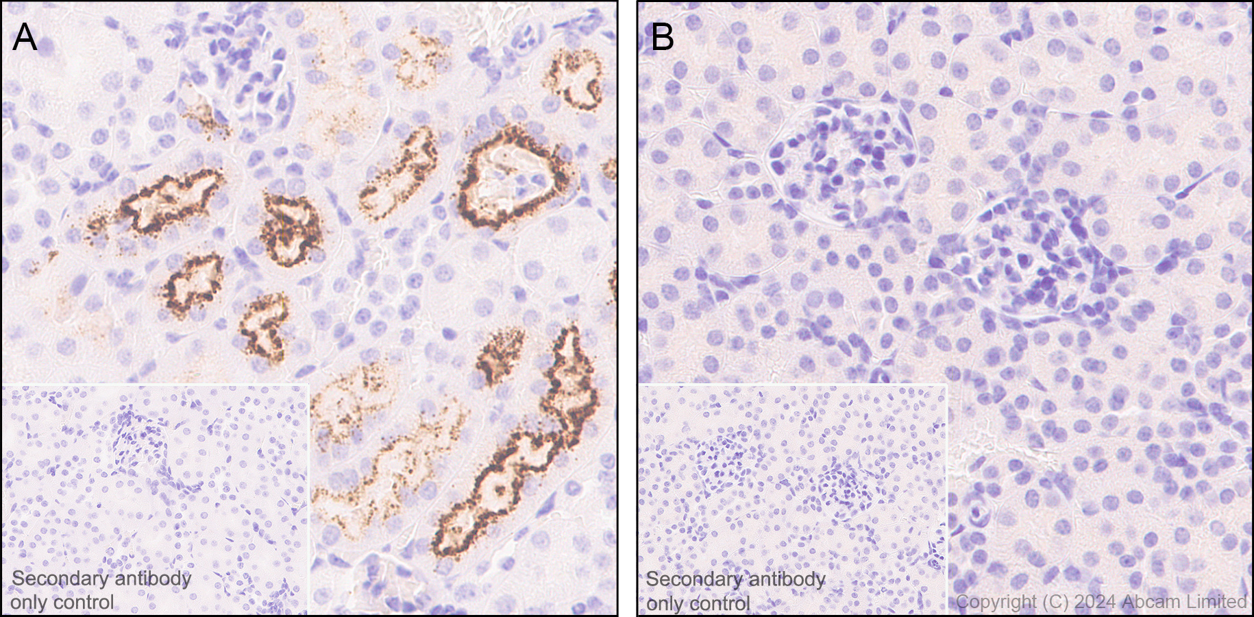 Immunohistochemistry (Formalin/PFA-fixed paraffin-embedded sections) - Anti-RBP4 antibody [EPR18020-115] (AB188230)