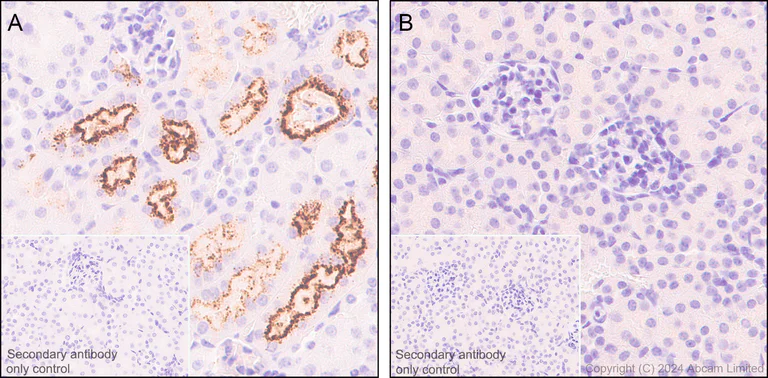 Immunohistochemistry (Formalin/PFA-fixed paraffin-embedded sections) - Anti-RBP4 antibody [EPR18020-115] - BSA and Azide free (AB227487)