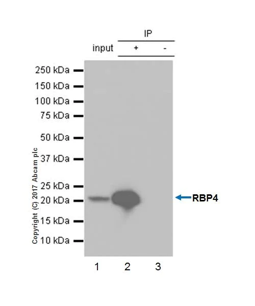 Immunoprecipitation - Anti-RBP4 antibody [EPR18020-115] - BSA and Azide free (AB227487)