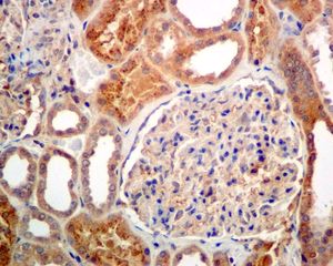 Immunohistochemistry (Formalin/PFA-fixed paraffin-embedded sections) - Anti-RBP4 antibody [EPR5878] (AB133530), expandable thumbnail