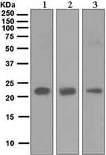 Western blot - Anti-RBP4 antibody [EPR5878] (AB133530), expandable thumbnail