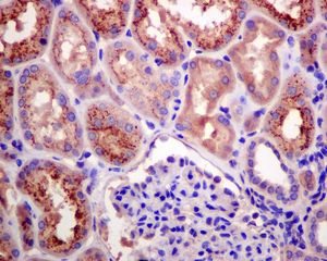 Immunohistochemistry (Formalin/PFA-fixed paraffin-embedded sections) - Anti-RBP4 antibody [EPR5879] (AB133559)