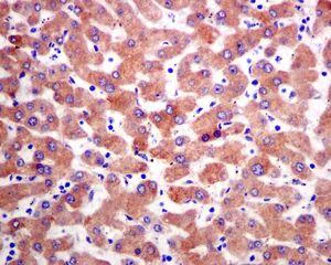 Immunohistochemistry (Formalin/PFA-fixed paraffin-embedded sections) - Anti-RBP4 antibody [EPR5879] (AB133559)