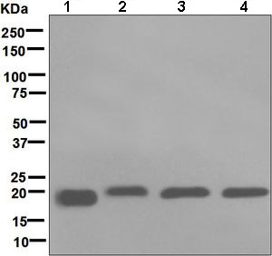 Western blot - Anti-RBP4 antibody [EPR5879] (AB133559)