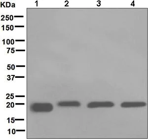 Western blot - Anti-RBP4 antibody [EPR5879] - BSA and Azide free (AB248553)