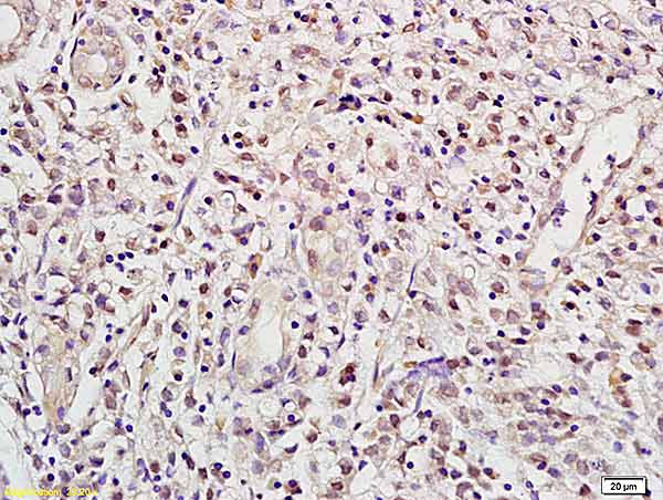 Immunohistochemistry (Formalin/PFA-fixed paraffin-embedded sections) - Anti-RBPJK antibody (AB217683)