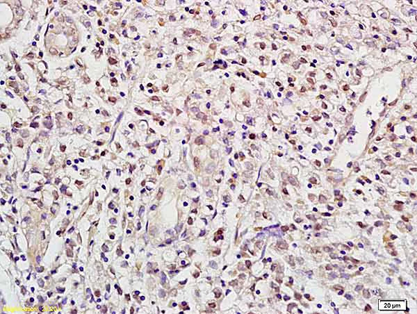 Immunohistochemistry (Formalin/PFA-fixed paraffin-embedded sections) - Anti-RBPJK antibody (AB217683)