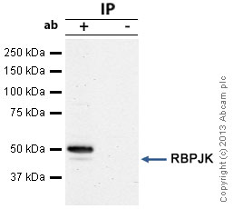 Anti-RBPJK antibody (ab25949) | Abcam