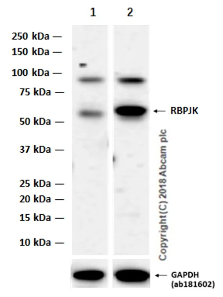 Western blot - Anti-RBPJK antibody [EPR13479] (AB180588)