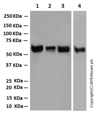 Western blot - Anti-RBPJK antibody [EPR13479] (AB180588)