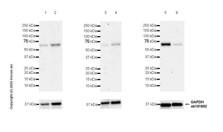 Western blot - Anti-RBPJK antibody [RM2045] - BSA and Azide free (AB317049)