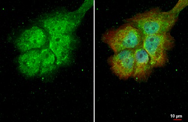 Immunocytochemistry/ Immunofluorescence - Anti-RBPMS antibody (ab152101), expandable thumbnail