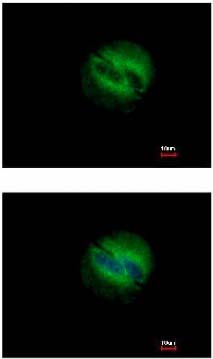 Immunocytochemistry/ Immunofluorescence - Anti-RBPMS antibody (ab152101), expandable thumbnail