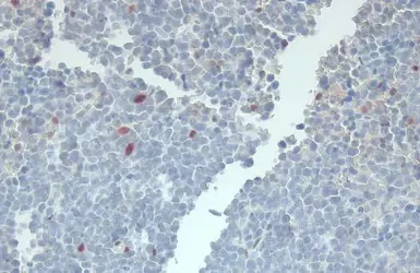 Immunohistochemistry (Formalin/PFA-fixed paraffin-embedded sections) - Anti-RBPMS antibody (AB152101)