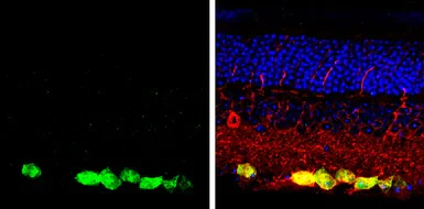 Immunohistochemistry (Formalin/PFA-fixed paraffin-embedded sections) - Anti-RBPMS antibody (AB152101)