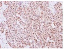 Immunohistochemistry (Formalin/PFA-fixed paraffin-embedded sections) - Anti-RBPMS antibody (AB152101), expandable thumbnail