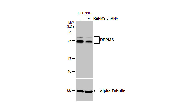 Anti-RBPMS antibody