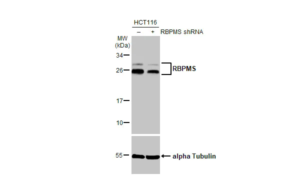Western blot - Anti-RBPMS antibody (AB152101)