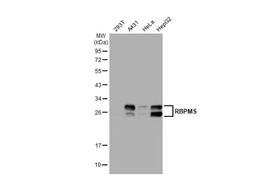 Western blot - Anti-RBPMS antibody (AB152101)