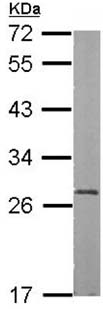 Western blot - Anti-RBPMS antibody (AB152101), expandable thumbnail
