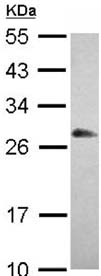 Western blot - Anti-RBPMS antibody (AB152101), expandable thumbnail