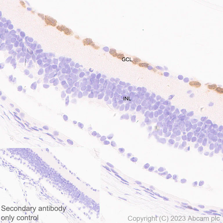 Immunohistochemistry (Formalin/PFA-fixed paraffin-embedded sections) - Anti-RBPMS antibody [EPR27130-21] (AB309094)