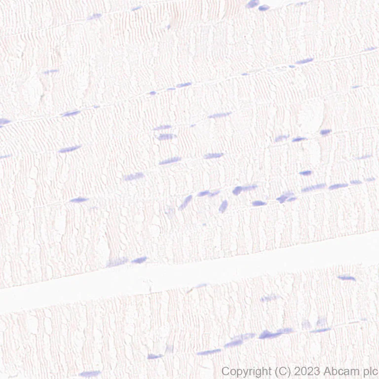 Immunohistochemistry (Formalin/PFA-fixed paraffin-embedded sections) - Anti-RBPMS antibody [EPR27130-21] (AB309094)