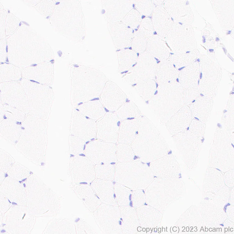 Immunohistochemistry (Formalin/PFA-fixed paraffin-embedded sections) - Anti-RBPMS antibody [EPR27130-21] - BSA and Azide free (AB309095)