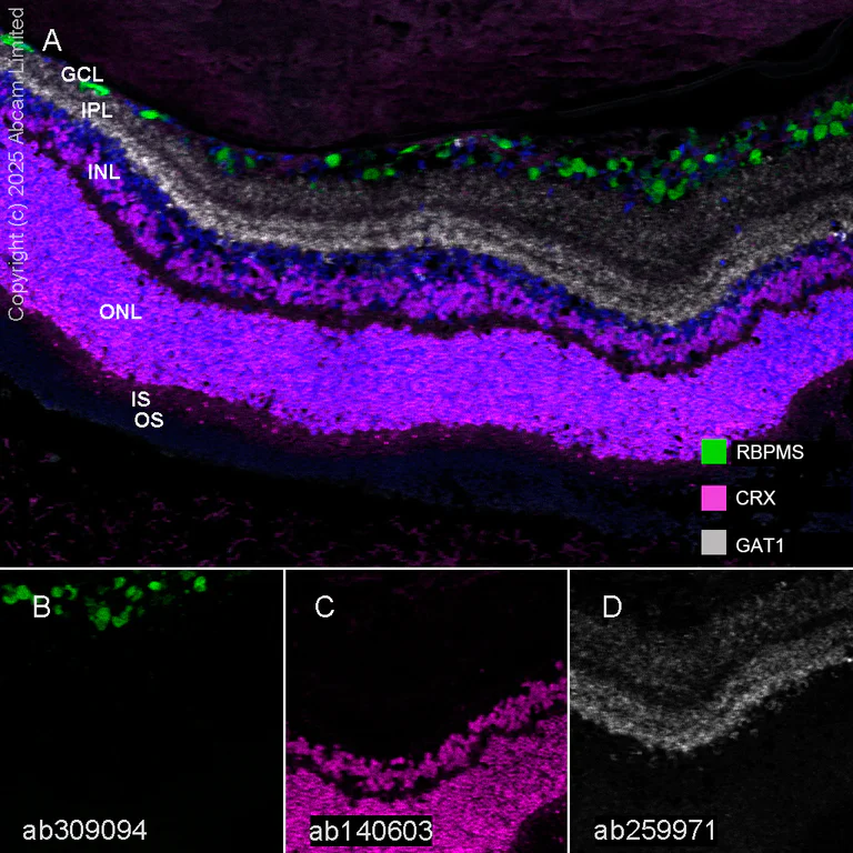 Multiplex immunohistochemistry - Anti-RBPMS antibody [EPR27130-21] - BSA and Azide free (AB309095)