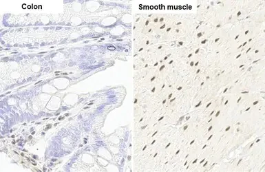 Immunohistochemistry (Formalin/PFA-fixed paraffin-embedded sections) - Anti-RBPMS antibody [HL1105] - BSA and Azide free (AB313829)