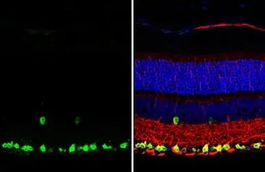 Immunohistochemistry (Formalin/PFA-fixed paraffin-embedded sections) - Anti-RBPMS antibody [HL1105] - BSA and Azide free (AB313829)