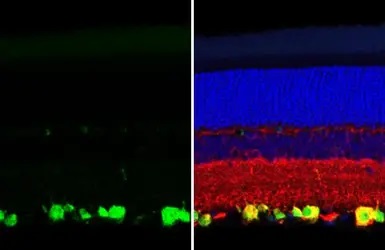 Immunohistochemistry (Formalin/PFA-fixed paraffin-embedded sections) - Anti-RBPMS antibody [HL1105] - BSA and Azide free (AB313829), expandable thumbnail