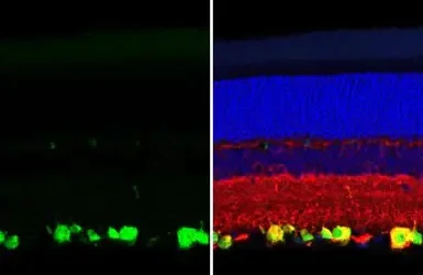 Immunohistochemistry (Formalin/PFA-fixed paraffin-embedded sections) - Anti-RBPMS antibody [HL1105] - BSA and Azide free (AB313829)