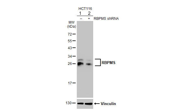 Western blot - Anti-RBPMS antibody [HL1105] - BSA and Azide free (AB313829), expandable thumbnail
