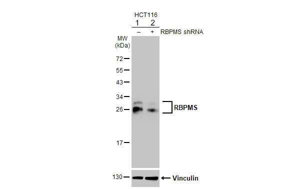 Western blot - Anti-RBPMS antibody [HL1105] - BSA and Azide free (AB313829)