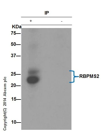 Immunoprecipitation - Anti-RBPMS2 antibody [EPR13121-79] (AB181098)