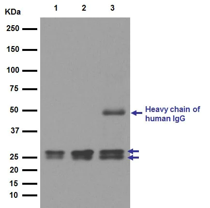 Western blot - Anti-RBPMS2 antibody [EPR13121-79] (AB181098)