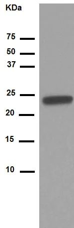Western blot - Anti-RBPMS2 antibody [EPR13121-79] (AB181098)