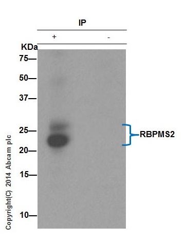 Immunoprecipitation - Anti-RBPMS2 antibody [EPR13121-79] - BSA and Azide free (AB250345), expandable thumbnail