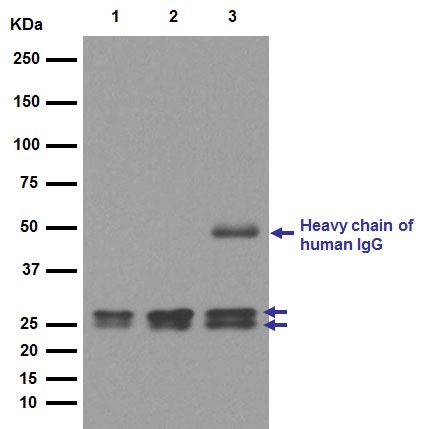 Western blot - Anti-RBPMS2 antibody [EPR13121-79] - BSA and Azide free (AB250345), expandable thumbnail