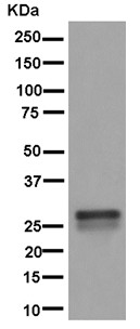 Western blot - Anti-RBPMS2 antibody [EPR13121-79] - BSA and Azide free (ab250345), expandable thumbnail