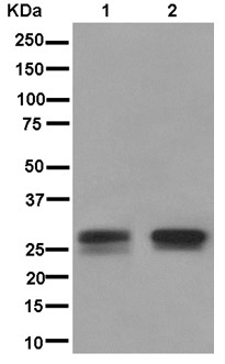 Western blot - Anti-RBPMS2 antibody [EPR13121-79] - BSA and Azide free (AB250345), expandable thumbnail