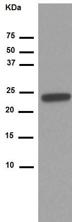 Western blot - Anti-RBPMS2 antibody [EPR13121-79] - BSA and Azide free (AB250345), expandable thumbnail