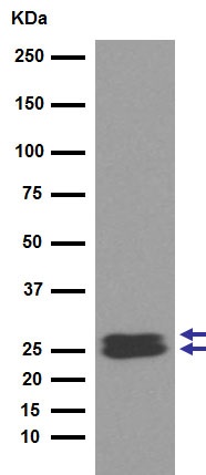 Western blot - Anti-RBPMS2 antibody [EPR13121-79] - BSA and Azide free (AB250345), expandable thumbnail
